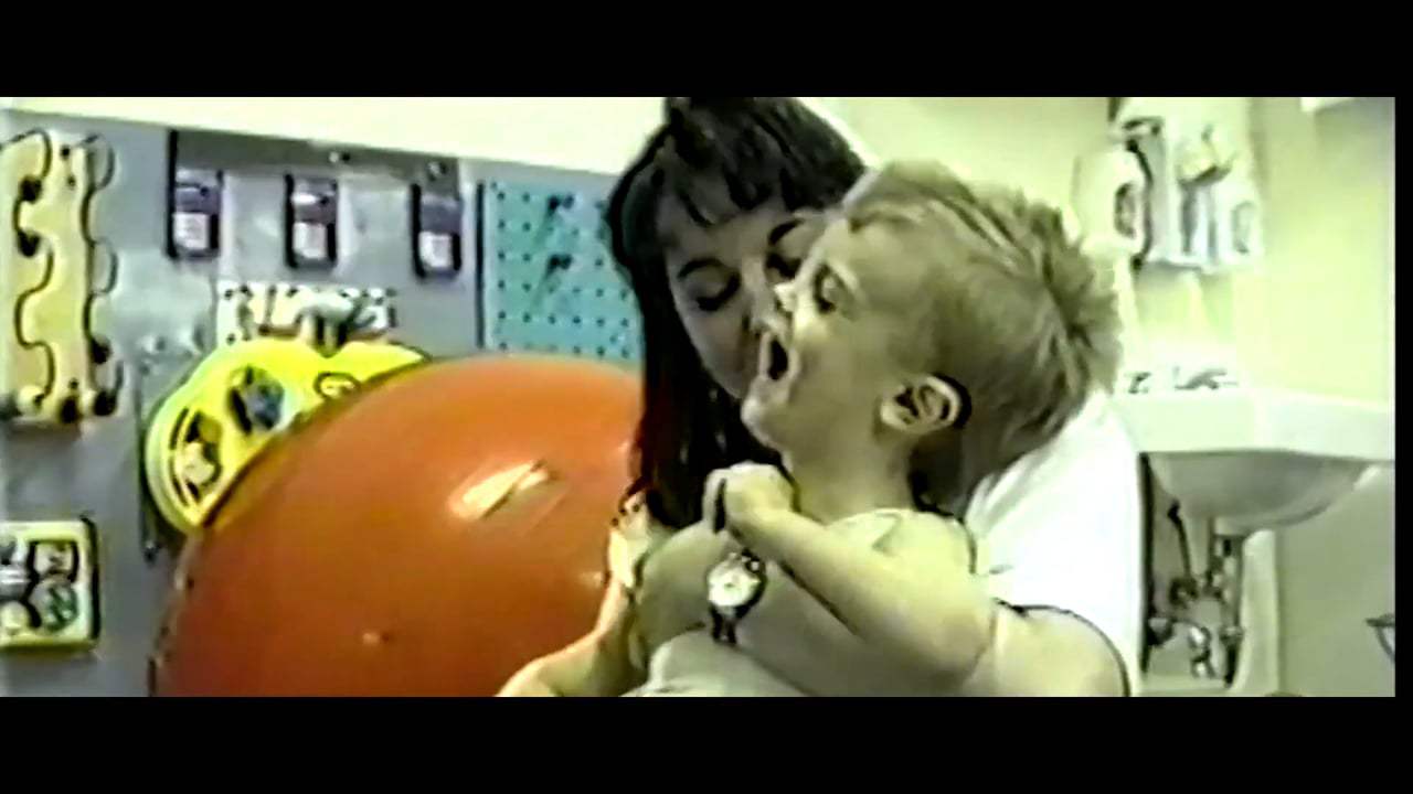 Patient Number Five: A Cure For The Elephant Man Trailer (2018) Screen Capture #3