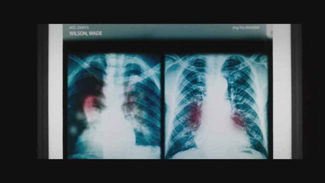 Deadpool 2 International Trailer (2018) Screen Capture #1