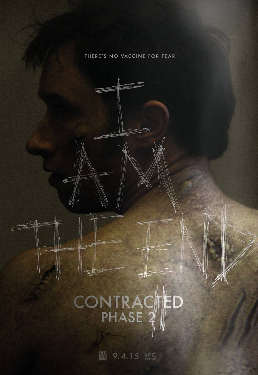 Contracted: Phase II Poster #1